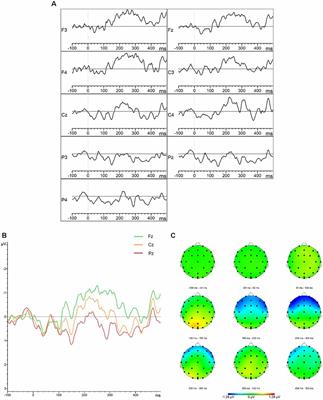 The Electrophysiological Correlates of Phoneme Perception in Primary Progressive Aphasia: A Preliminary Case Series